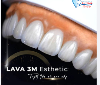 RĂNG SỨ LAVA ESTHETIC LÀ GÌ?