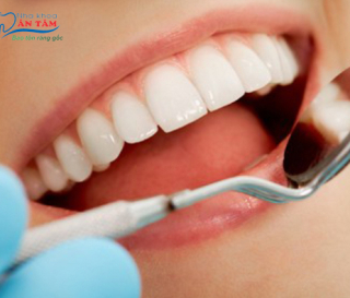 NHA KHOA BẢO TỒN - NÊN KHÁM RĂNG ĐỊNH KỲ BAO LÂU MỘT LẦN?