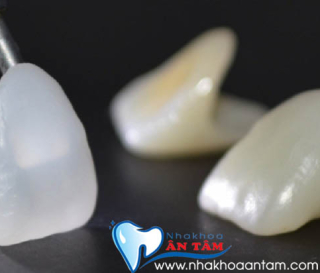 SO SÁNH ƯU NHƯỢC ĐIỂM GIỮA RĂNG SỨ ZIRCONIA VÀ CERCON