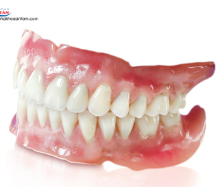 RĂNG SỨ THÁO LẮP – PHỤC HÌNH MẤT NHIỀU RĂNG