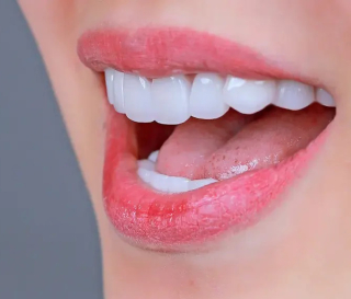 NHA KHOA BẢO TỒN - RĂNG KHỂNH CÓ BỌC SỨ ĐƯỢC KHÔNG?