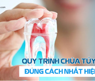 QUY TRÌNH ĐIỀU TRỊ TỦY RĂNG ĐÚNG CHUẨN NHẤT HIỆN NAY.