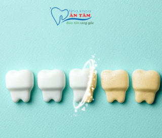 NHA KHOA BẢO TỒN - NGUYÊN NHÂN KHIẾN RĂNG BỊ XỈN MÀU