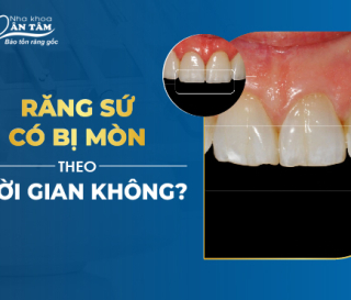 NHA KHOA BẢO TỒN - RĂNG SỨ CÓ BỊ MÒN THEO THỜI GIAN KHÔNG?