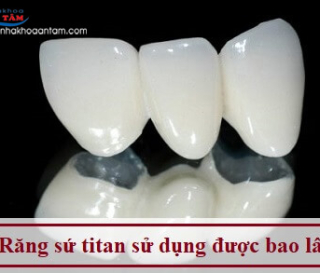 RĂNG SỨ TITAN SỬ DỤNG ĐƯỢC BAO LÂU