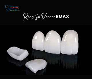 NHA KHOA BẢO TỒN - DÁN SỨ VENEER EMAX