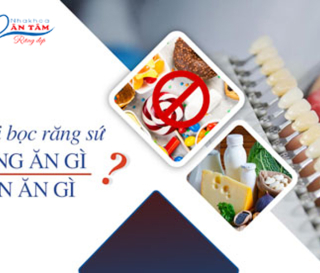 SAU KHI BỌC RĂNG SỨ NÊN KIÊNG GÌ?