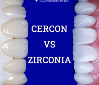 ƯU NHƯỢC ĐIỂM GIỮA RĂNG SỨ ZIRCONIA VÀ CERCON