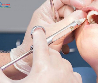 NHA KHOA BẢO TỒN - CÁC TÁC DỤNG PHỤ CỦA THUỐC TÊ NHỔ RĂNG?