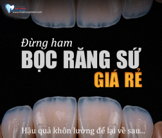 HẬU QUẢ KHÔN LƯỜNG KHI BỌC RĂNG SỨ GIÁ RẺ?