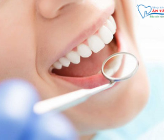 NHỮNG YẾU TỐ ẢNH HƯỞNG ĐẾN CHI PHÍ TRỒNG RĂNG SỨ