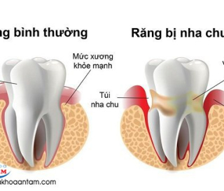 CẤU TẠO RĂNG CỦA NGƯỜI