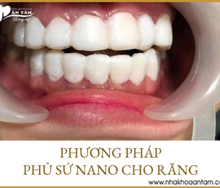 PHỦ SỨ NANO VÀ NHỮNG TÁC HẠI KHÔNG NGỜ ĐẾN
