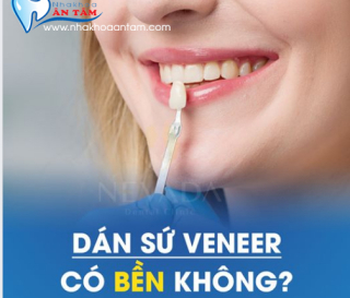MẶT DÁN SỨ VENEER CÓ BỀN KHÔNG?