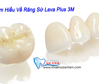 RĂNG SỨ LAVA CỦA NƯỚC NÀO? CÓ MẤY LOẠI? ƯU NHƯỢC ĐIỂM RA SAO?