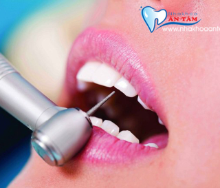 BỌC RĂNG SỨ KHÔNG CẦN MÀI RĂNG CÓ ĐƯỢC KHÔNG?
